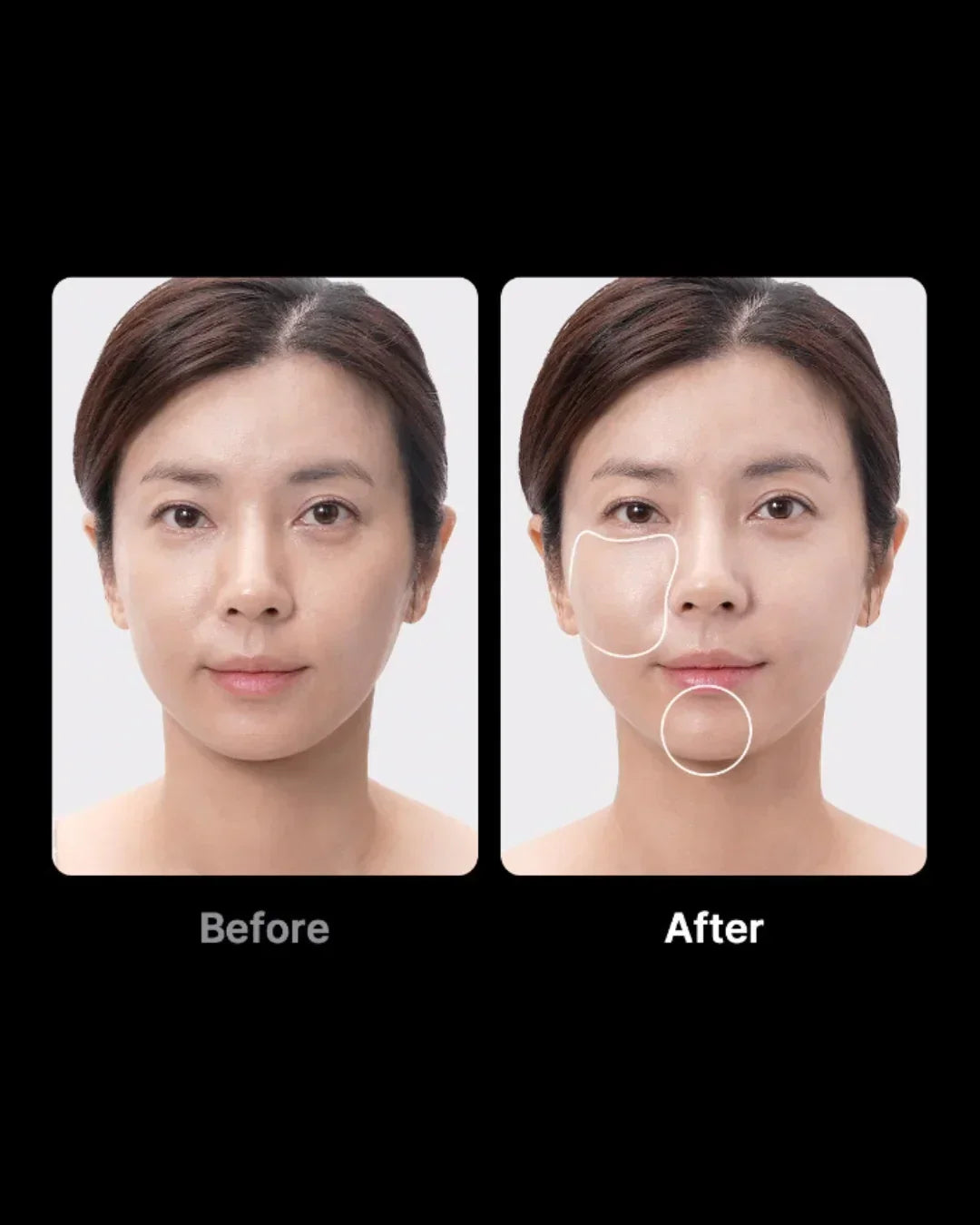 Before and after comparison of a woman’s face showing visible skin improvement, Korean beauty device results