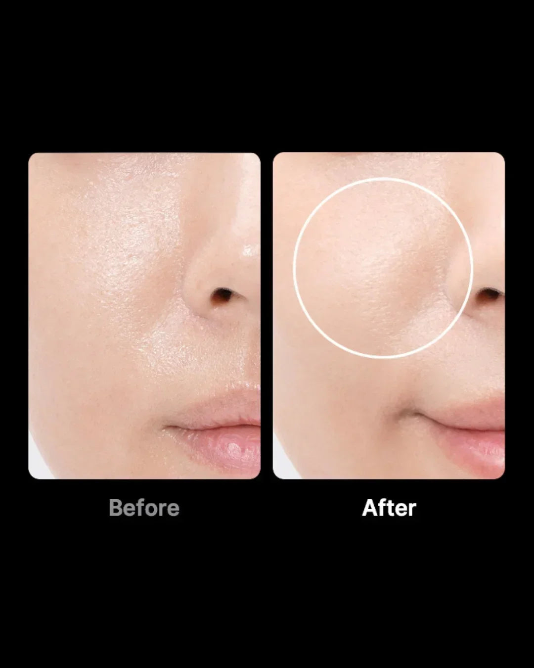 Before and after close-up of skin using Korean beauty device, smoother complexion shown.