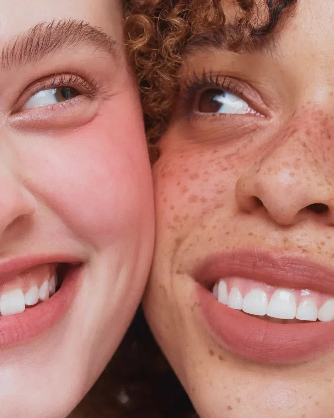 Close-up of two smiling diverse women showing natural skin textures, freckles, and healthy teeth