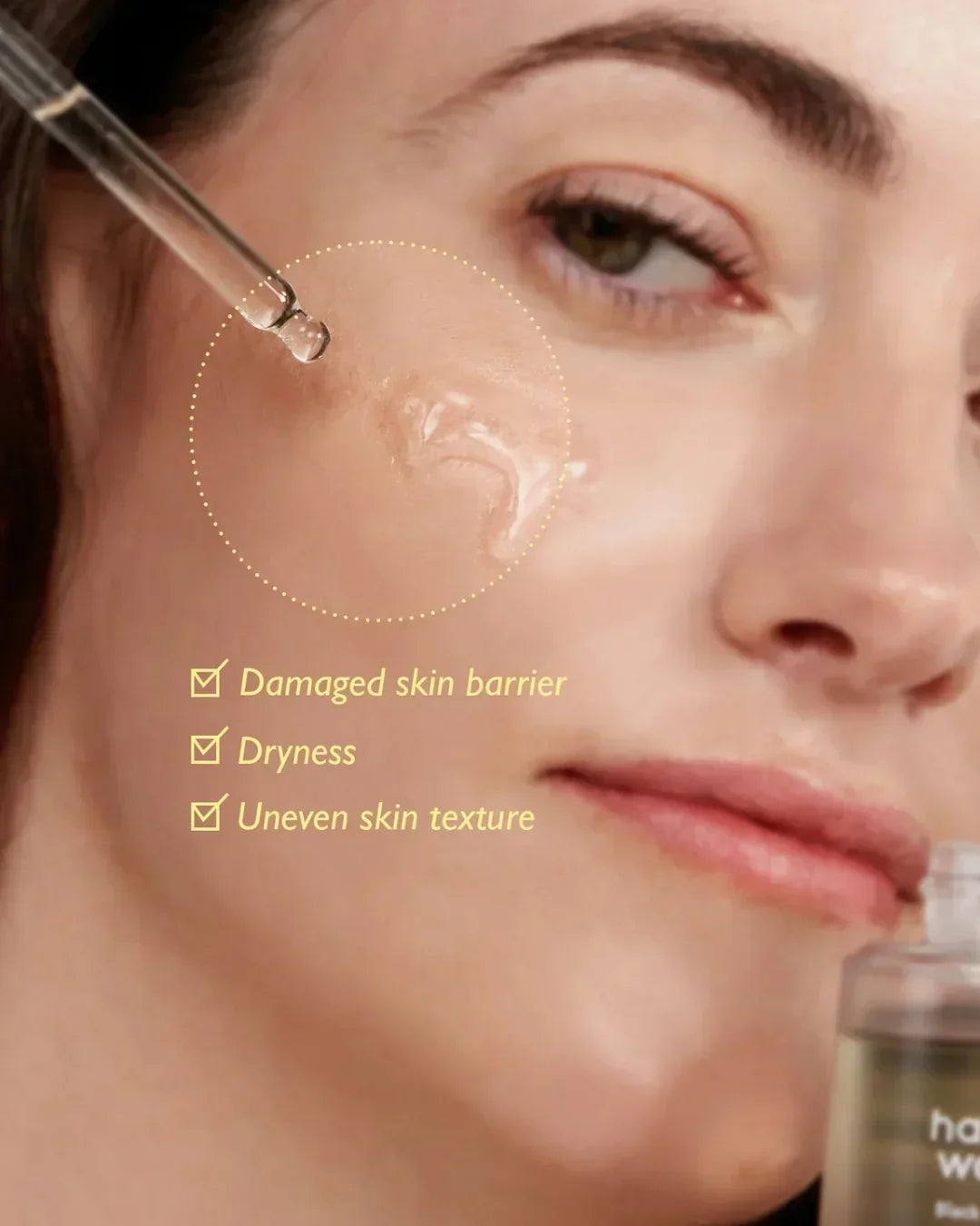 Close-up of woman applying facial serum with dropper on cheek, highlighting damaged skin barrier, dryness, uneven texture